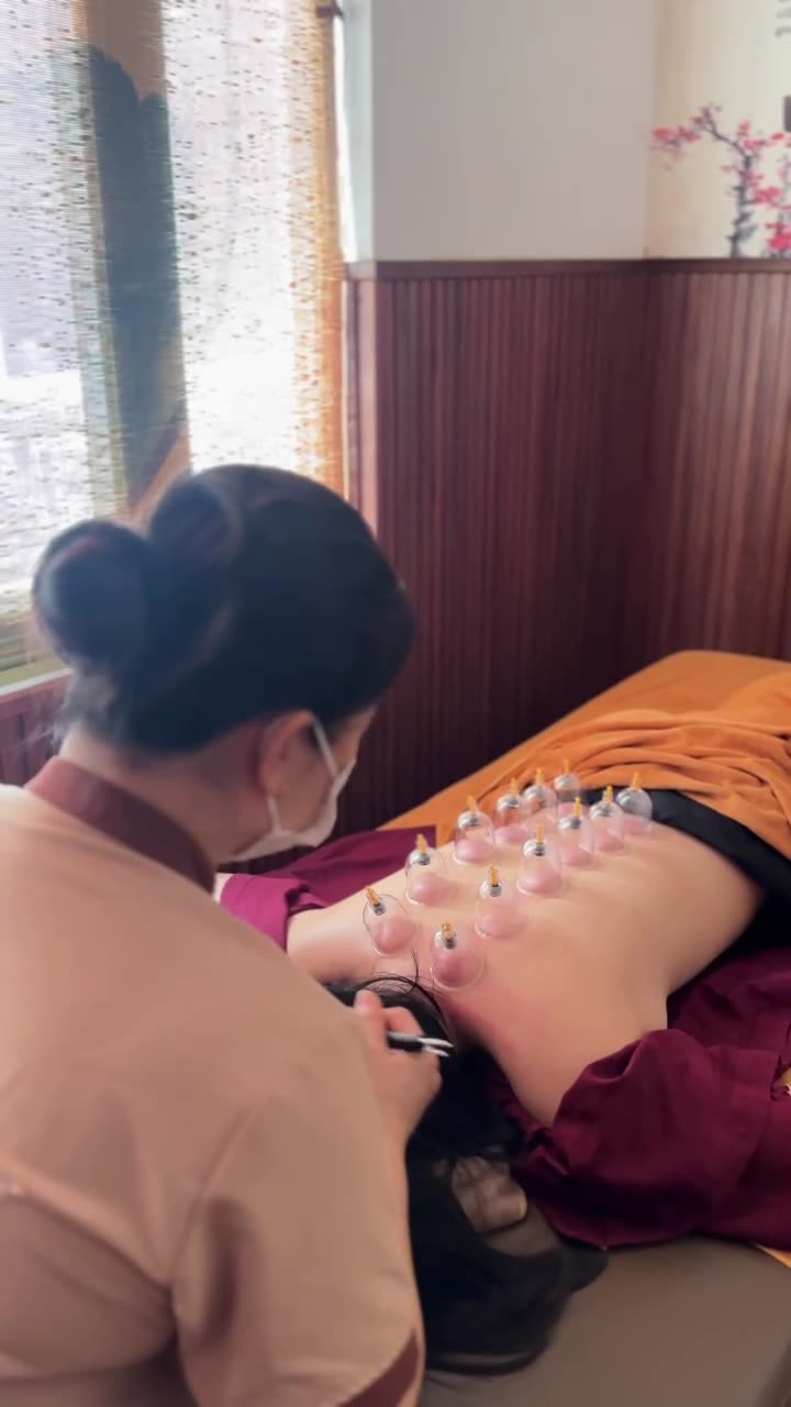 Kỹ thuật viên ngồi ở đầu giường dùng dụng cụ chăm vùng gáy, trên lưng khách là hàng ống giác hơi